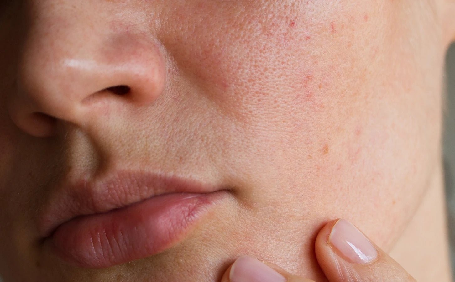 Pellicules sur un seul côté du visage - Prendre soin de sa peau
