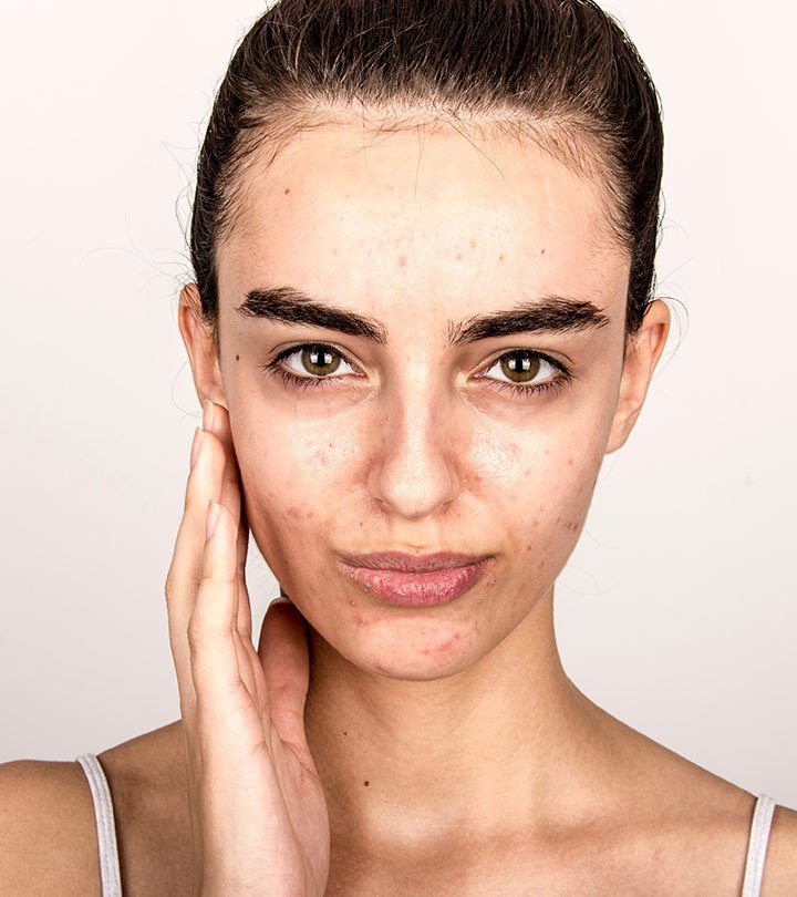 Carte du visage de l’acné : ce que vos éruptions essaient de vous dire