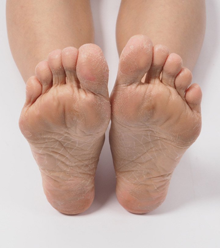 Comment enlever la peau morte des pieds
